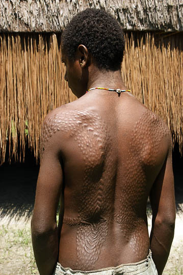 Scarifications on an initiated young man's back in Yamok, the Sepik River 2009