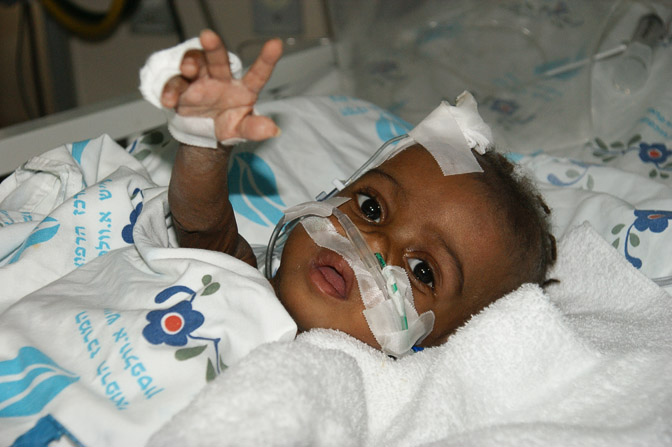 Alexandre from Angola, The Wolfson Hospital 2011